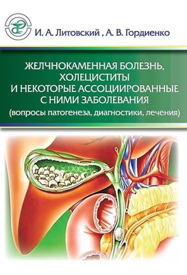 Жовчнокам'яна хвороба, холецистити та деякі асоційовані з ними захворювання (питання патогенезу, 1317dg фото